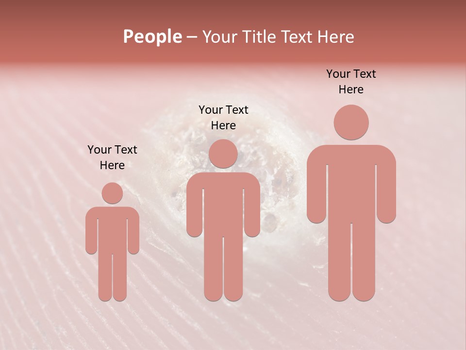 Macro Close Up Papillomavirus PowerPoint Template