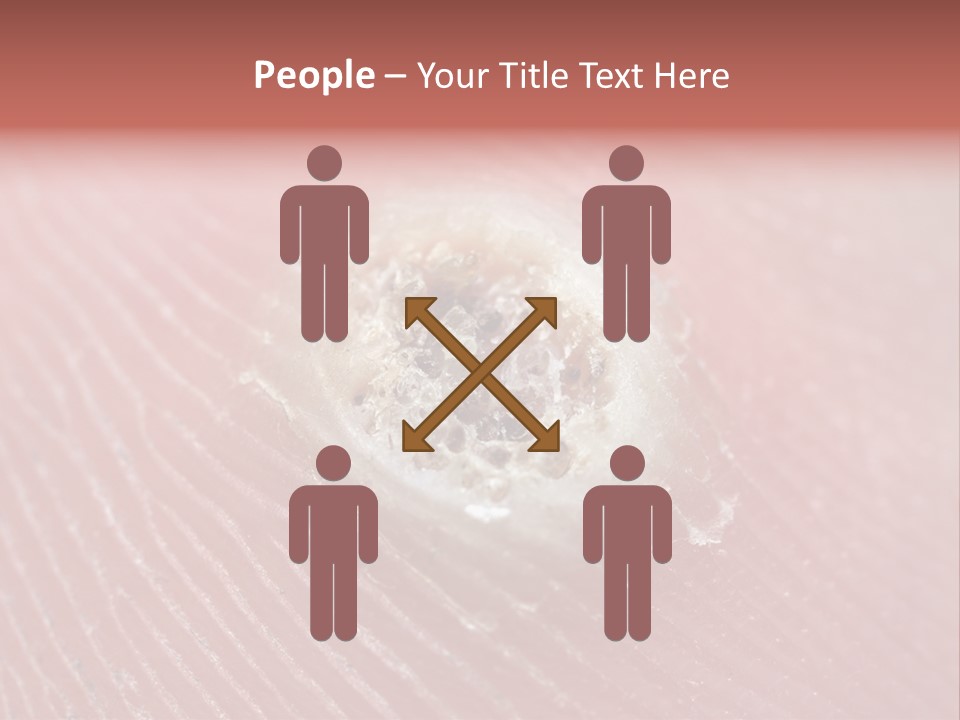 Macro Close Up Papillomavirus PowerPoint Template