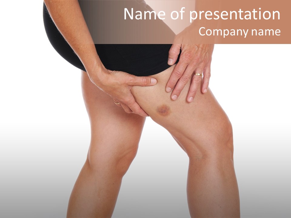 Slim Arm Injury PowerPoint Template