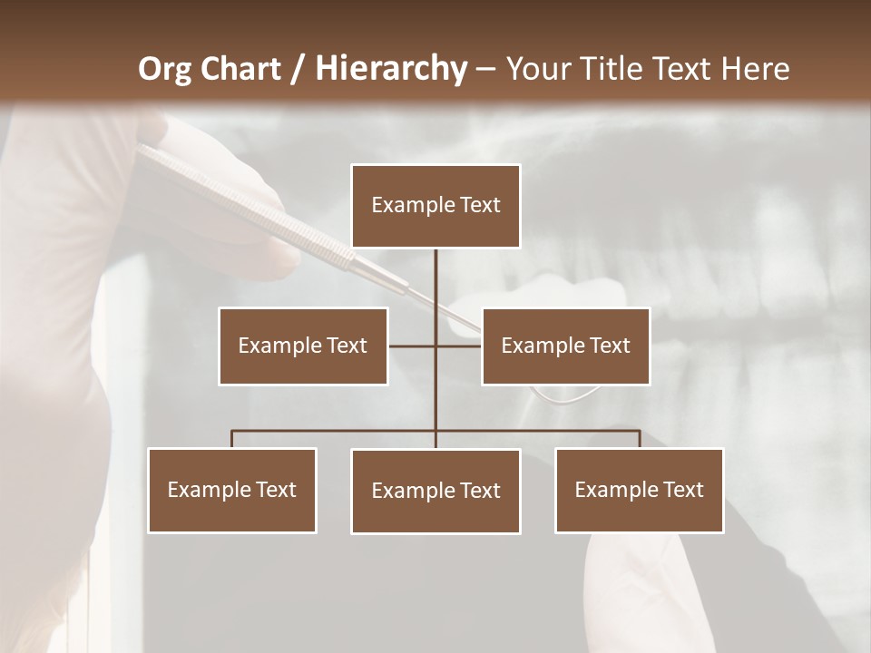 A Person Holding A Toothbrush In Front Of An X - Ray PowerPoint Template