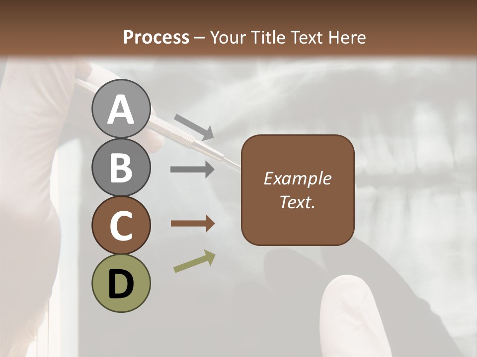 A Person Holding A Toothbrush In Front Of An X - Ray PowerPoint Template