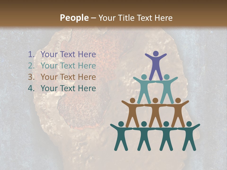 Dealing With Dementia Senior Adult Rusting PowerPoint Template