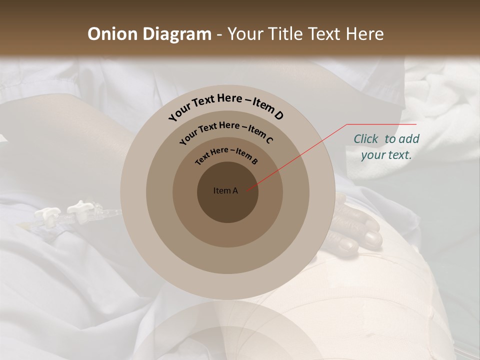 Surgery Medical Instrument Pain PowerPoint Template