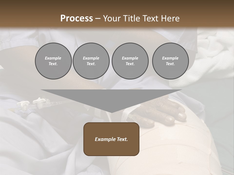 Surgery Medical Instrument Pain PowerPoint Template