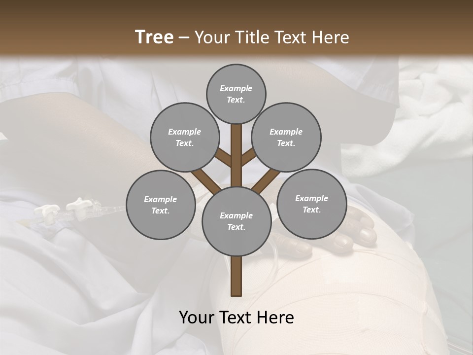 Surgery Medical Instrument Pain PowerPoint Template