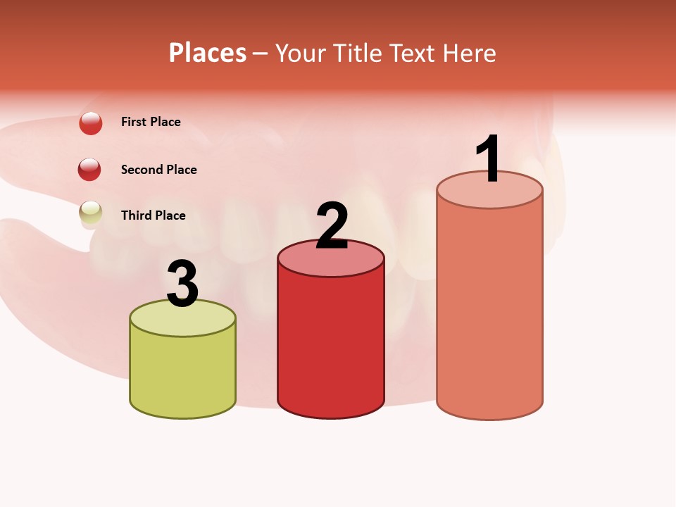 Upper Prosthetic Equipment Human Teeth PowerPoint Template