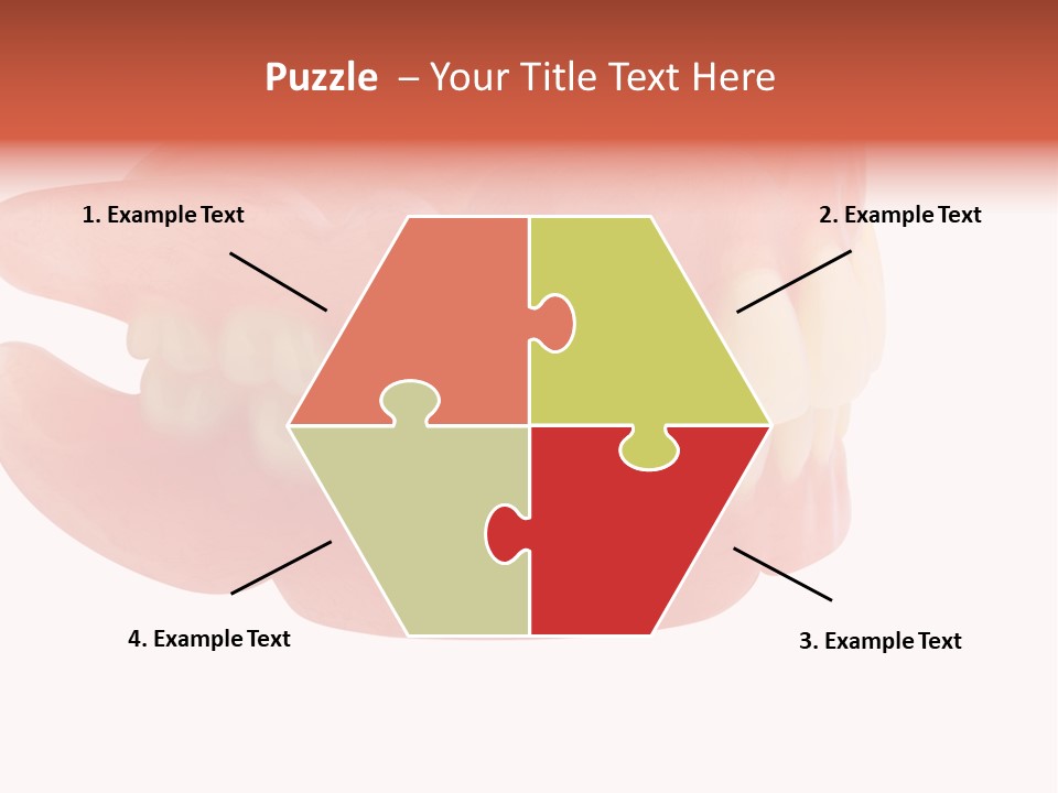 Upper Prosthetic Equipment Human Teeth PowerPoint Template