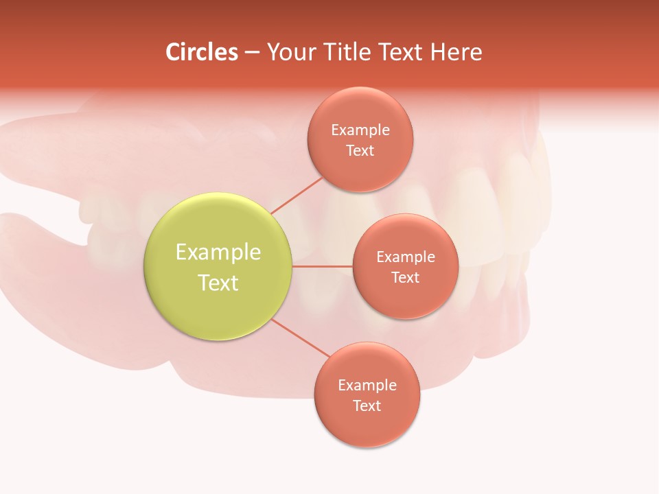 Upper Prosthetic Equipment Human Teeth PowerPoint Template
