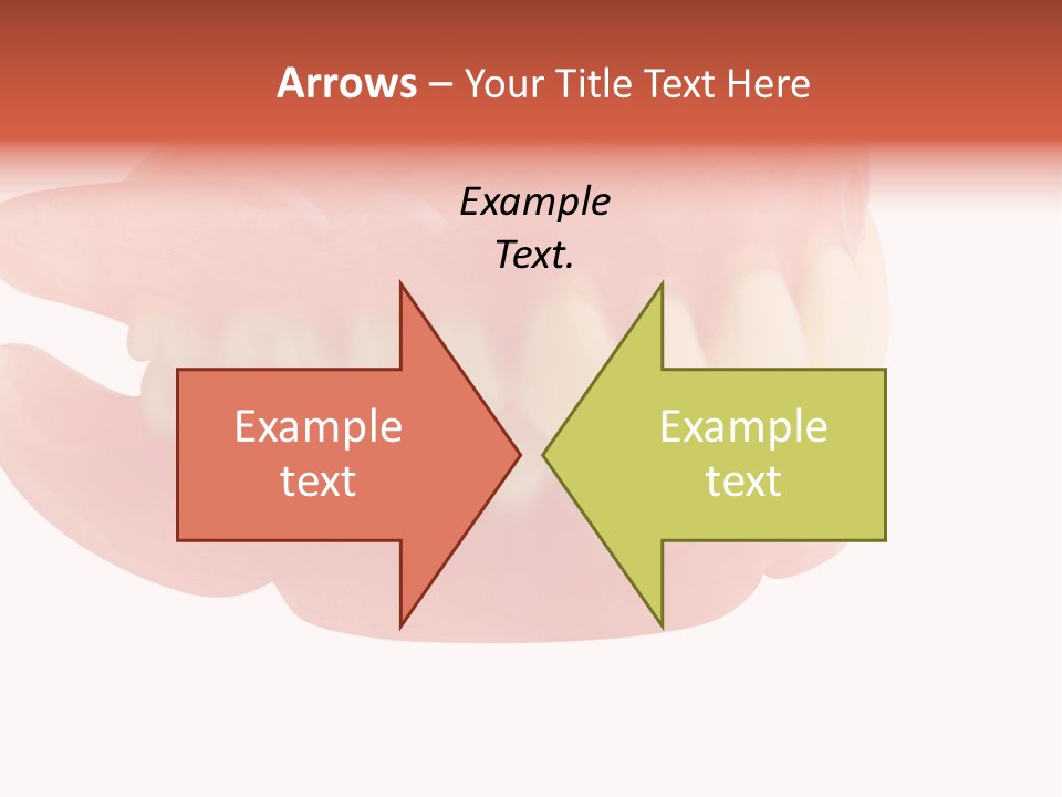 Upper Prosthetic Equipment Human Teeth PowerPoint Template