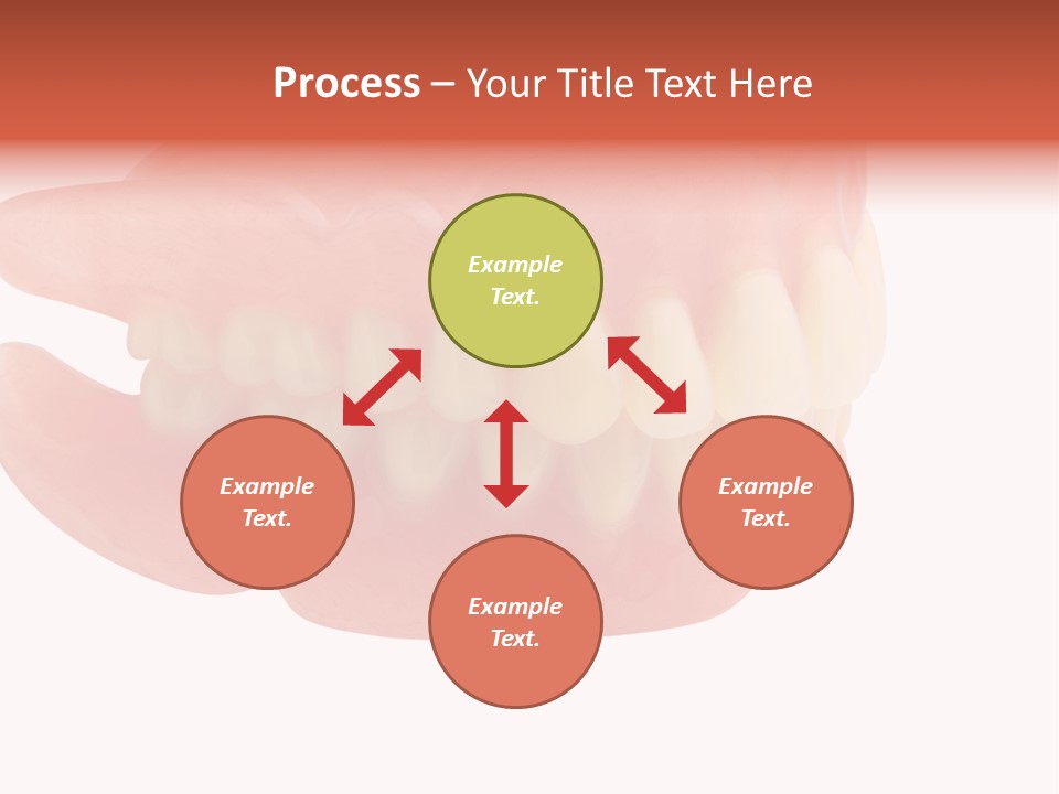 Upper Prosthetic Equipment Human Teeth PowerPoint Template