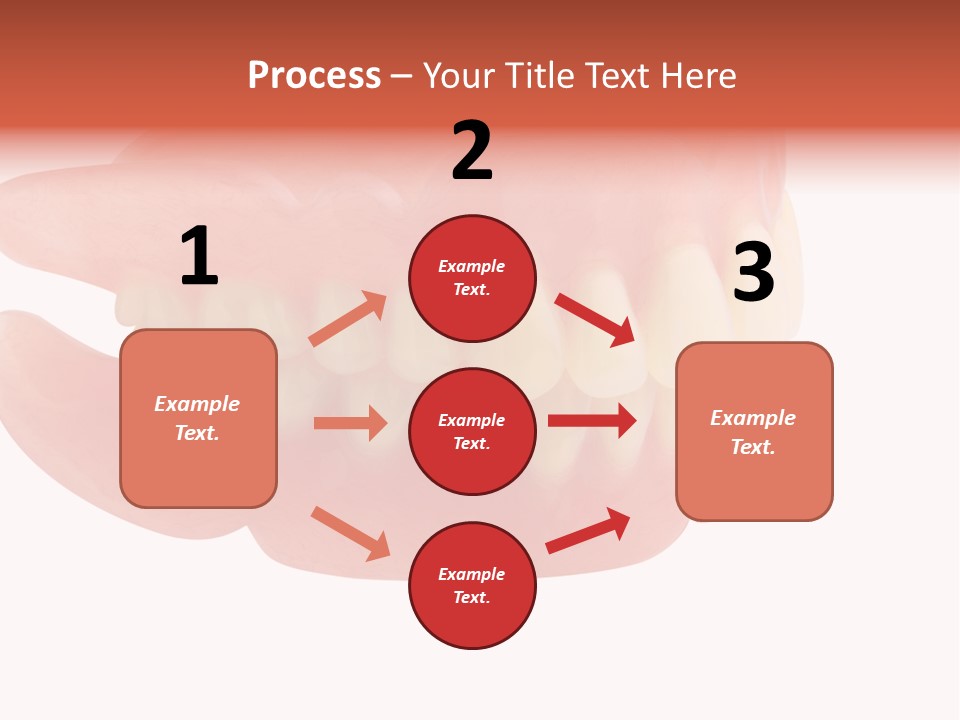 Upper Prosthetic Equipment Human Teeth PowerPoint Template