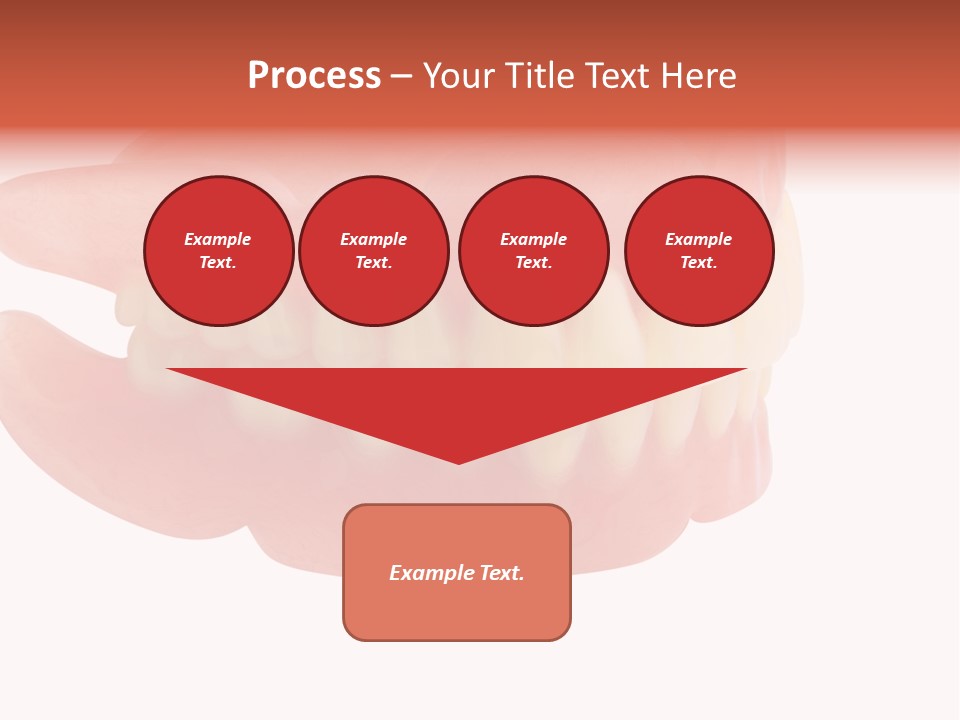 Upper Prosthetic Equipment Human Teeth PowerPoint Template