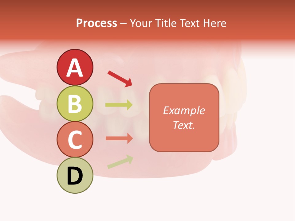 Upper Prosthetic Equipment Human Teeth PowerPoint Template