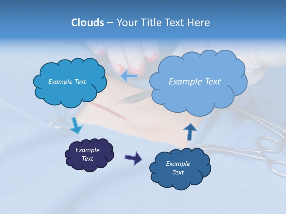 Surgery Tools Operating Theater Operating PowerPoint Template