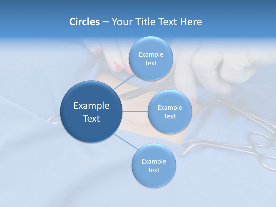 Surgery Tools Operating Theater Operating PowerPoint Template
