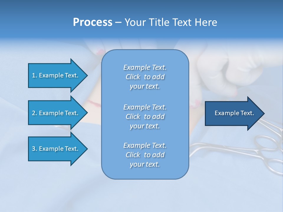 Surgery Tools Operating Theater Operating PowerPoint Template