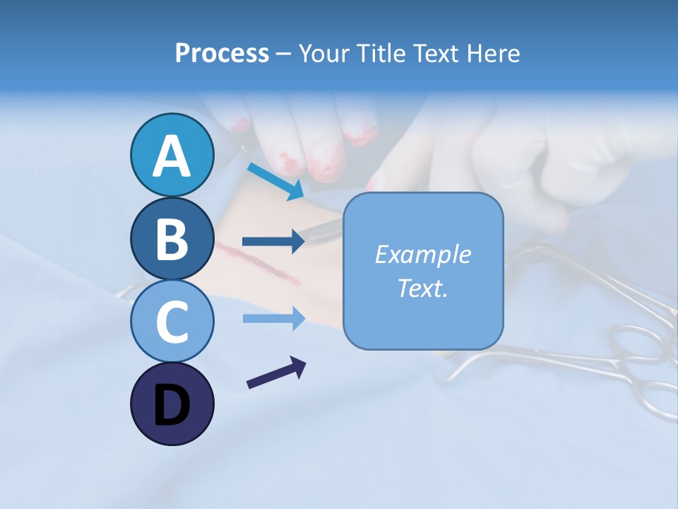 Surgery Tools Operating Theater Operating PowerPoint Template