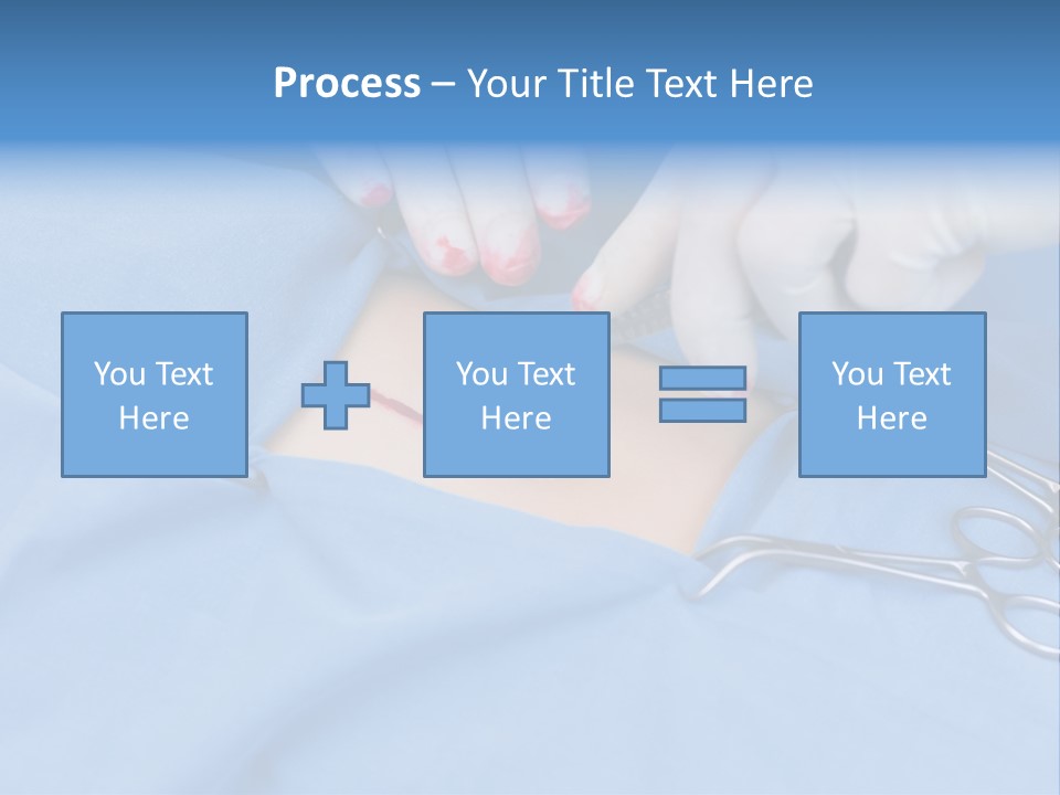 Surgery Tools Operating Theater Operating PowerPoint Template
