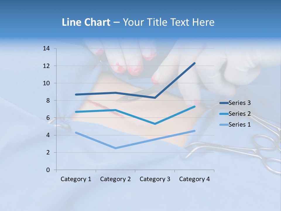 Surgery Tools Operating Theater Operating PowerPoint Template