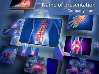 Human Joint Health Care Pain PowerPoint Template