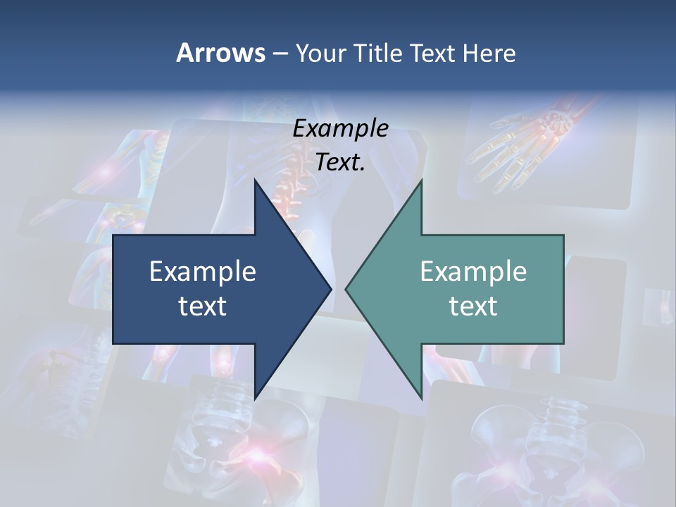 Human Joint Health Care Pain PowerPoint Template