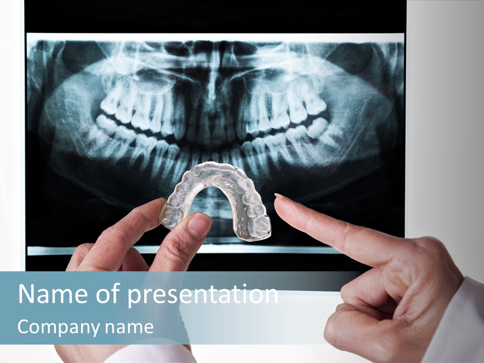 A Person Holding A Tooth In Front Of A X - Ray PowerPoint Template