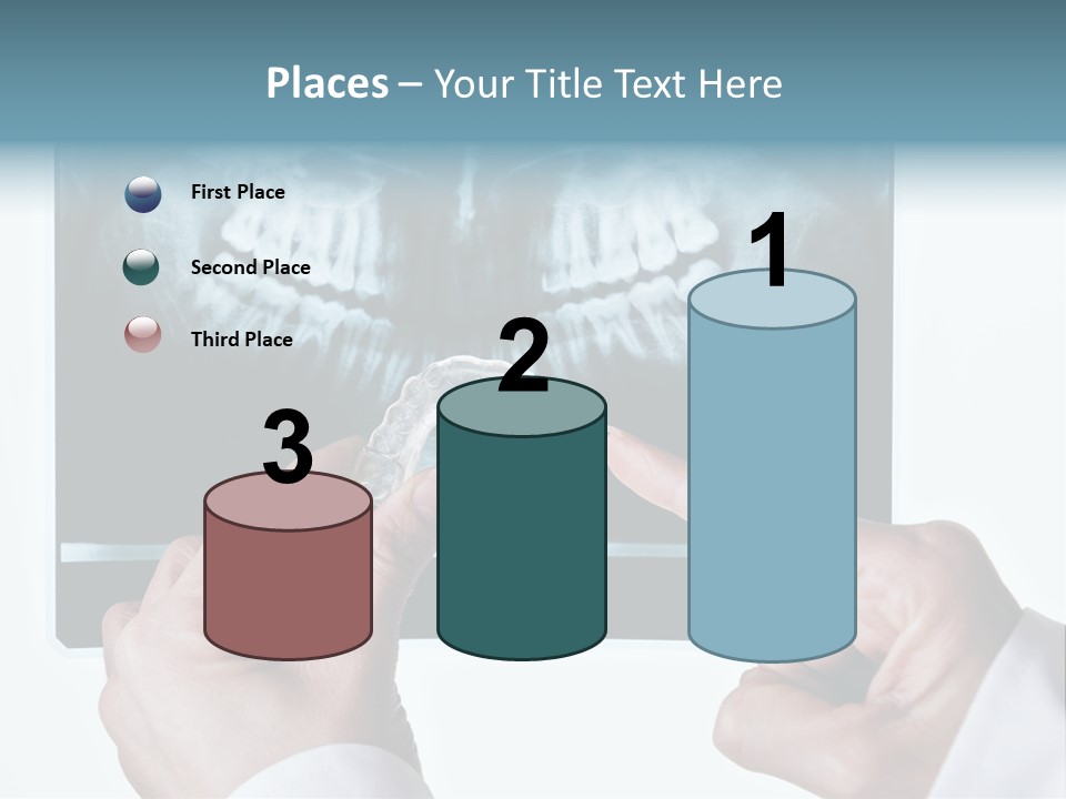 A Person Holding A Tooth In Front Of A X - Ray PowerPoint Template