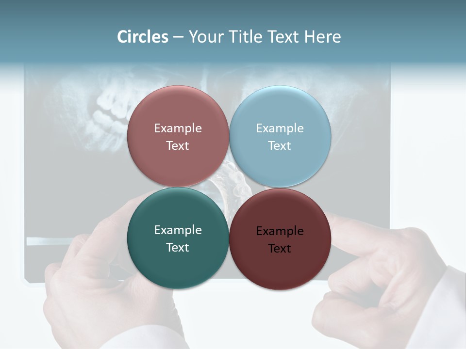 A Person Holding A Tooth In Front Of A X - Ray PowerPoint Template