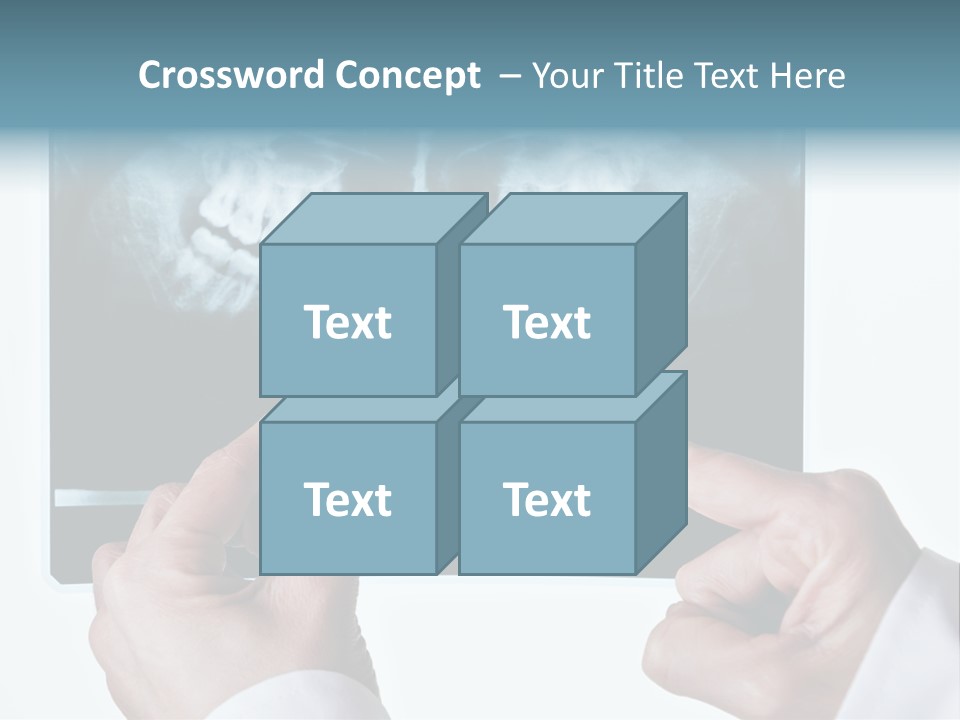 A Person Holding A Tooth In Front Of A X - Ray PowerPoint Template