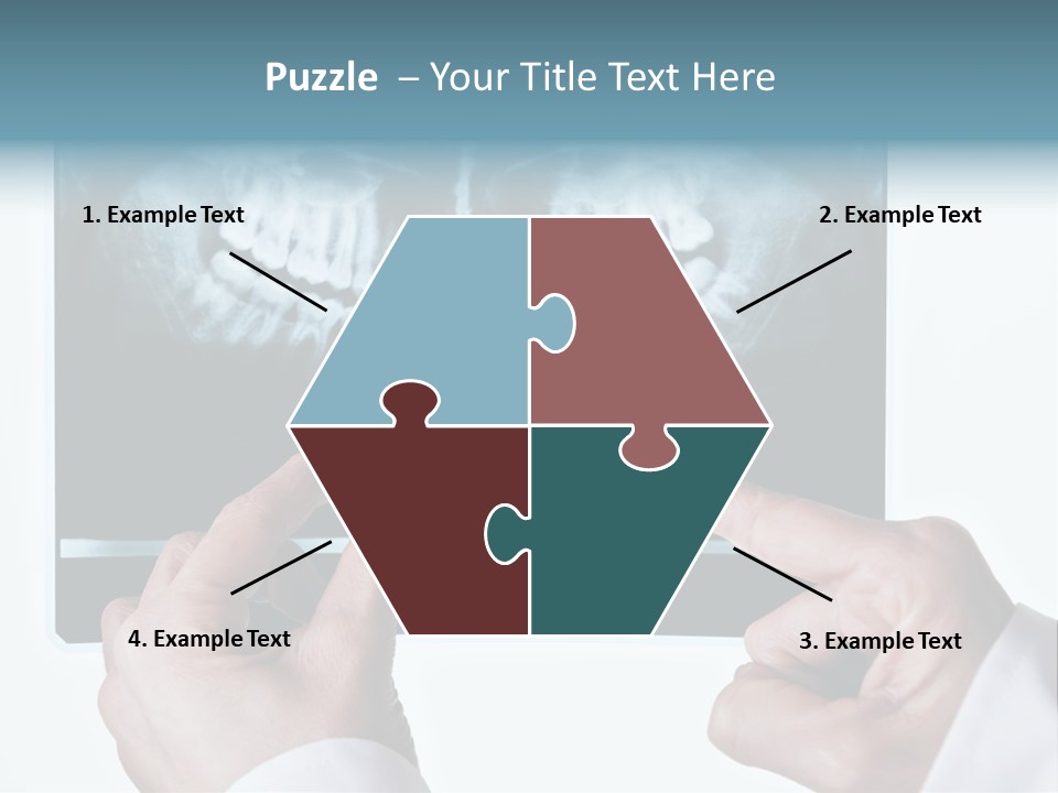 A Person Holding A Tooth In Front Of A X - Ray PowerPoint Template
