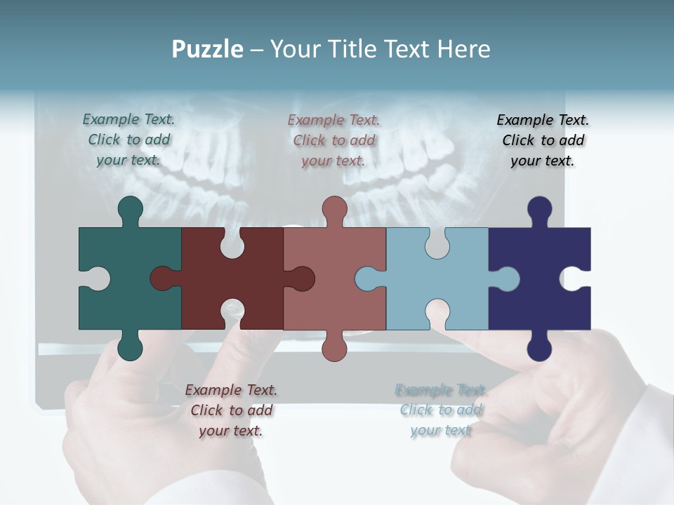 A Person Holding A Tooth In Front Of A X - Ray PowerPoint Template