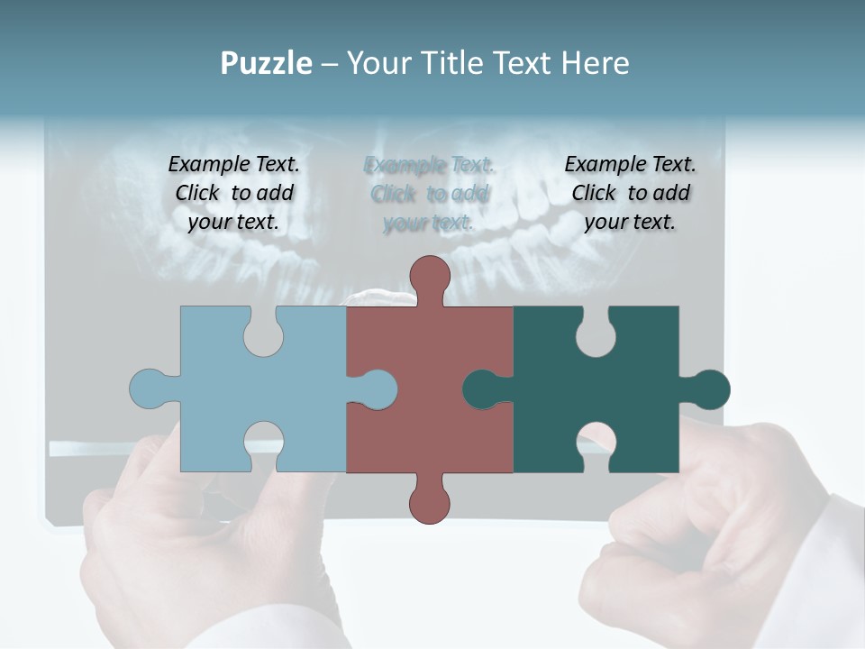 A Person Holding A Tooth In Front Of A X - Ray PowerPoint Template