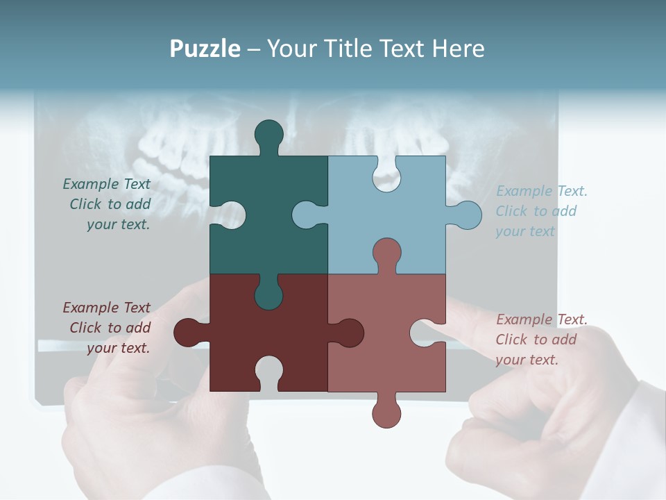 A Person Holding A Tooth In Front Of A X - Ray PowerPoint Template