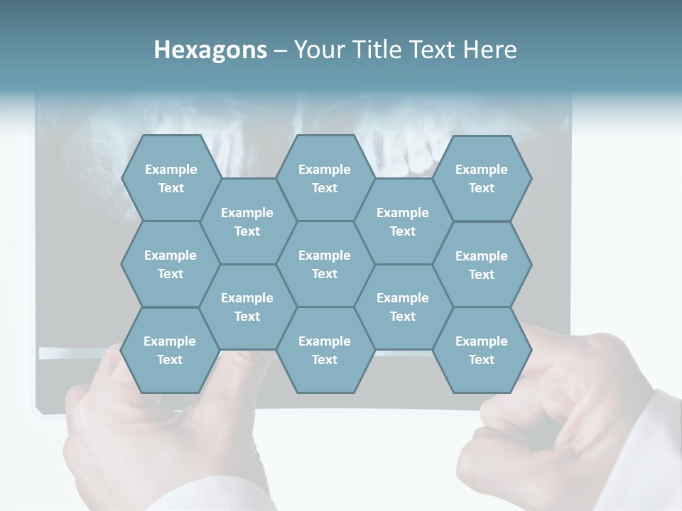 A Person Holding A Tooth In Front Of A X - Ray PowerPoint Template