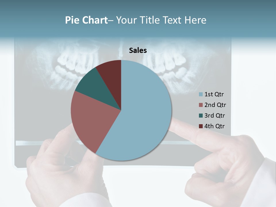 A Person Holding A Tooth In Front Of A X - Ray PowerPoint Template