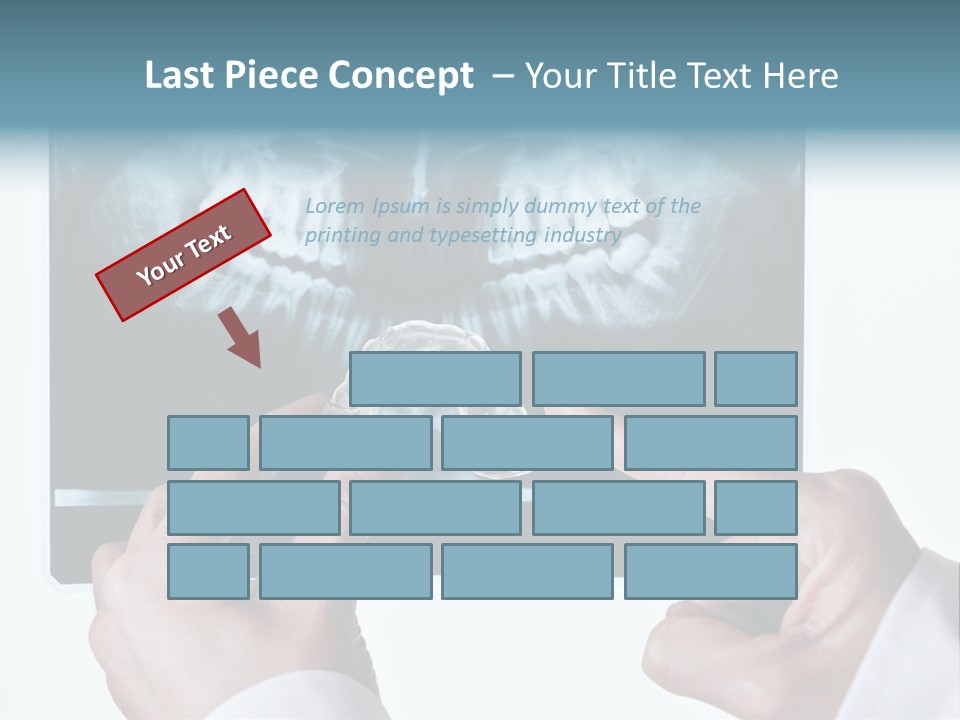 A Person Holding A Tooth In Front Of A X - Ray PowerPoint Template