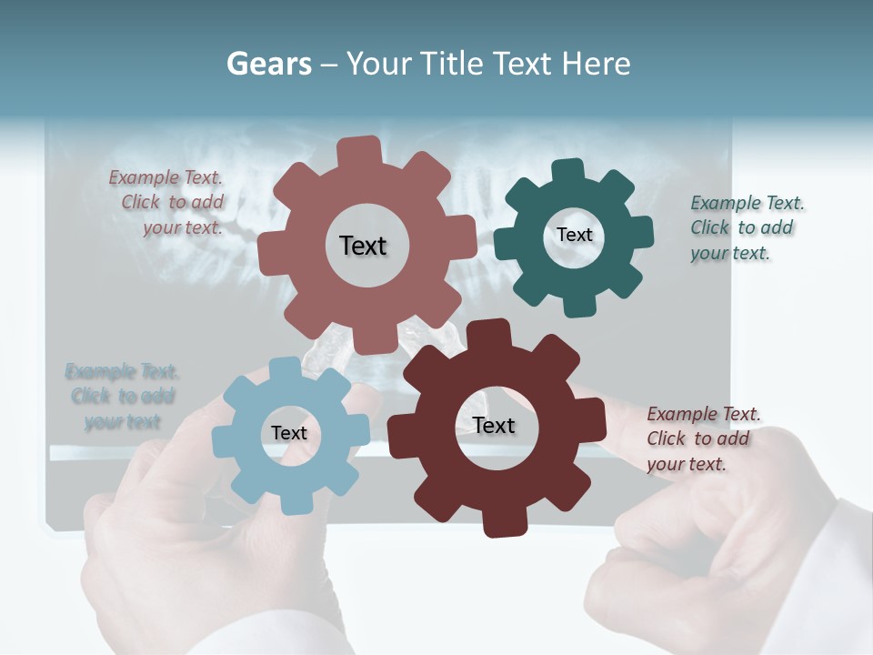 A Person Holding A Tooth In Front Of A X - Ray PowerPoint Template