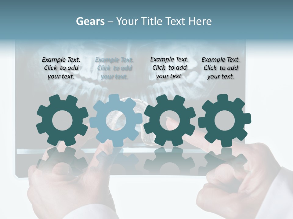 A Person Holding A Tooth In Front Of A X - Ray PowerPoint Template