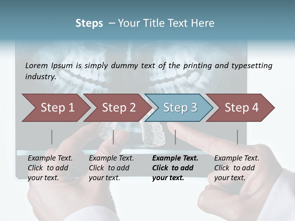 A Person Holding A Tooth In Front Of A X - Ray PowerPoint Template