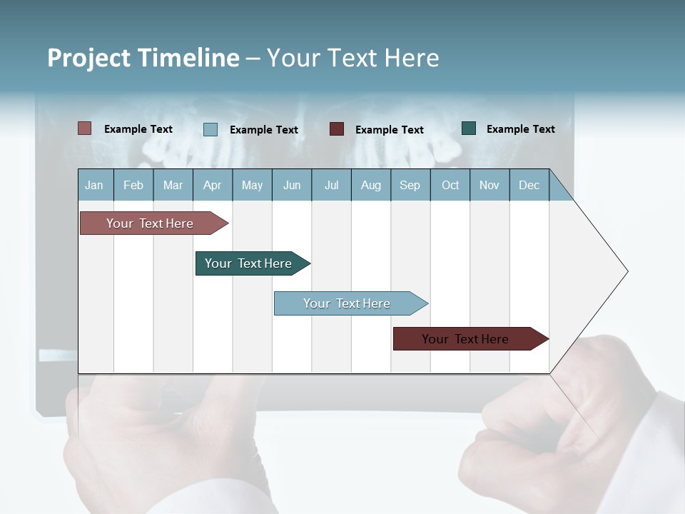 A Person Holding A Tooth In Front Of A X - Ray PowerPoint Template