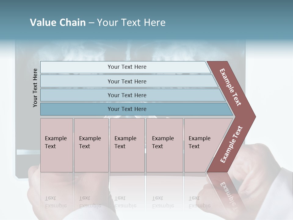 A Person Holding A Tooth In Front Of A X - Ray PowerPoint Template