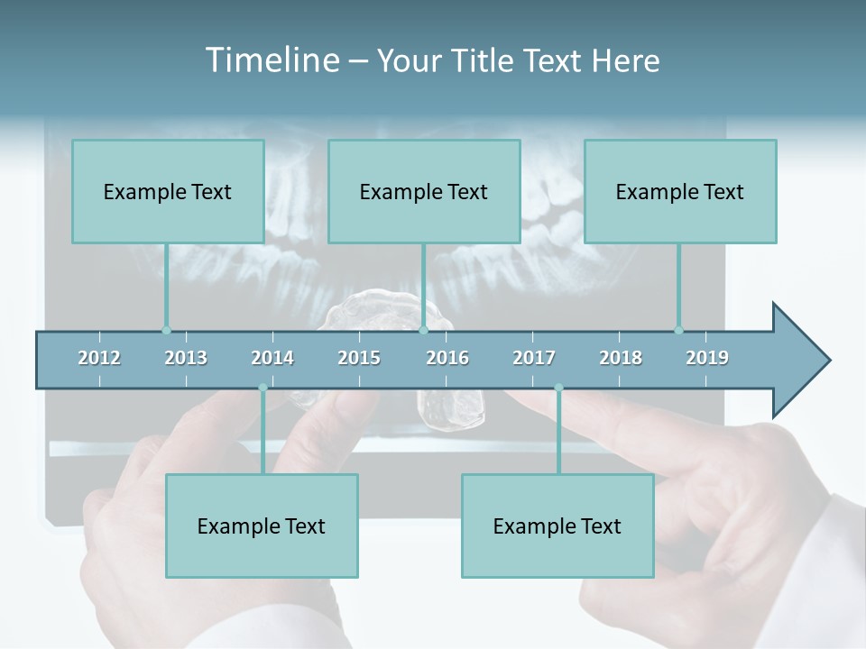 A Person Holding A Tooth In Front Of A X - Ray PowerPoint Template