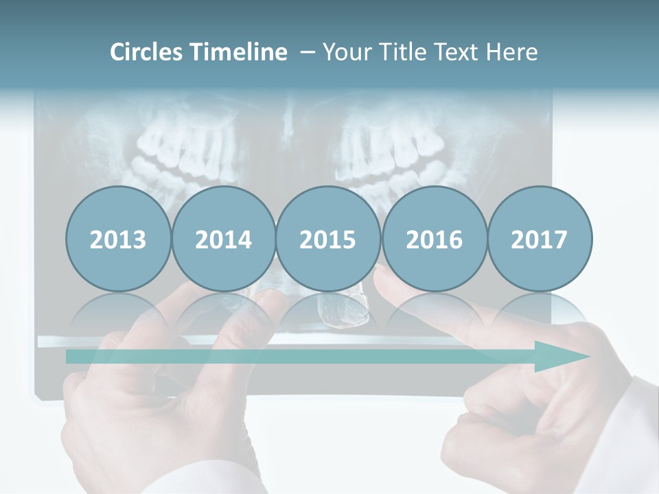 A Person Holding A Tooth In Front Of A X - Ray PowerPoint Template