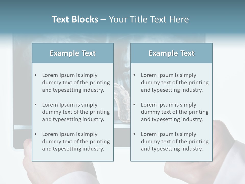 A Person Holding A Tooth In Front Of A X - Ray PowerPoint Template