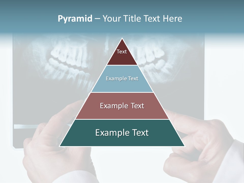 A Person Holding A Tooth In Front Of A X - Ray PowerPoint Template
