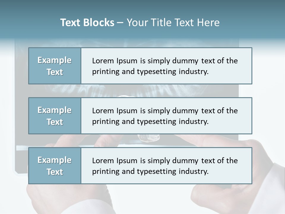 A Person Holding A Tooth In Front Of A X - Ray PowerPoint Template