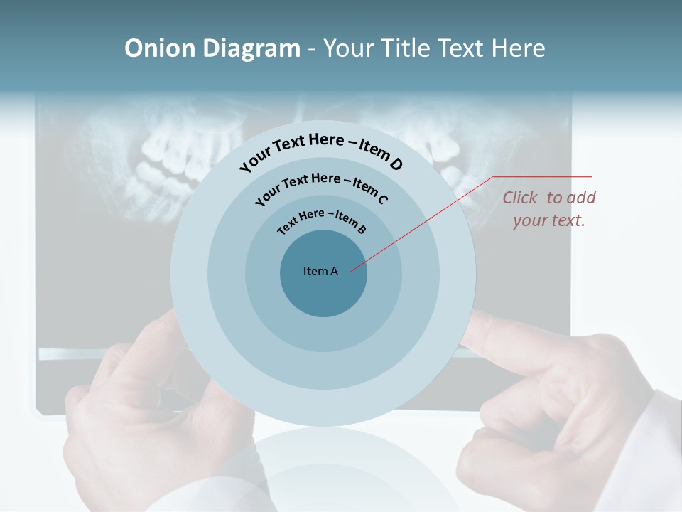 A Person Holding A Tooth In Front Of A X - Ray PowerPoint Template