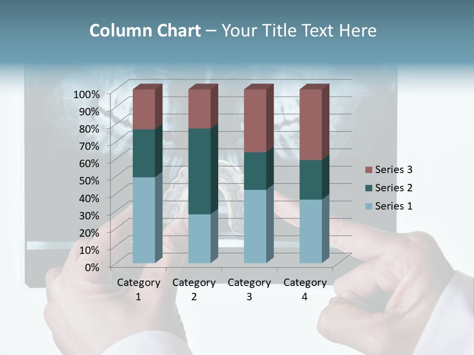 A Person Holding A Tooth In Front Of A X - Ray PowerPoint Template
