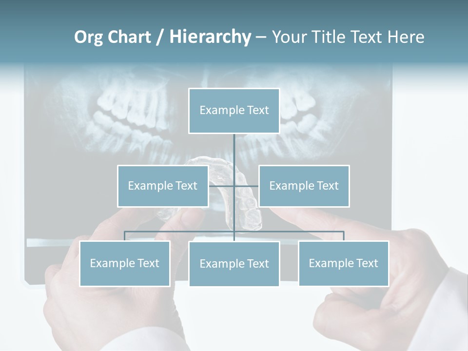 A Person Holding A Tooth In Front Of A X - Ray PowerPoint Template