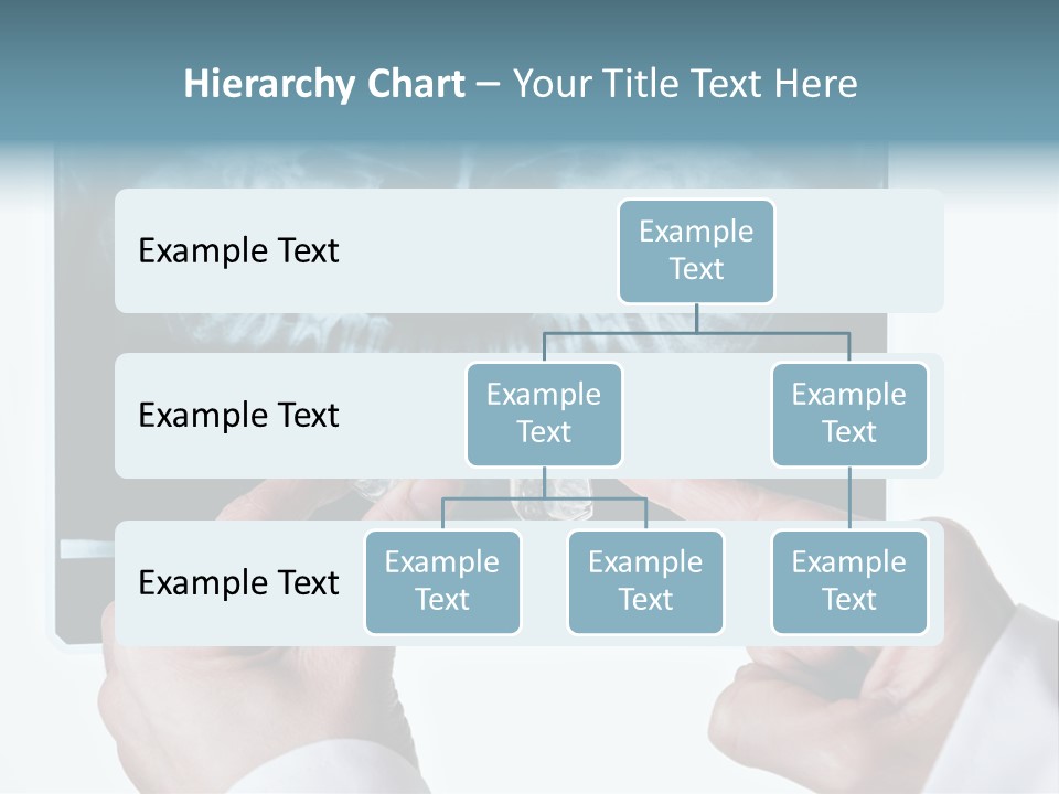 A Person Holding A Tooth In Front Of A X - Ray PowerPoint Template